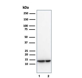 Western blot testing of human 1) LNCaP and 2) PC3 cell lysates using MIF antibody (clone MIF/3489). 