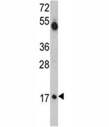 UBE2V1 Antibody