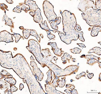 IHC staining of FFPE human placental tissue with 4-Alpha-glucanotransferase antibody. HIER: boil tissue sections in pH8 EDTA for 20 min and allow to cool before testing.