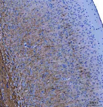 Neurofilament Antibody (Light)