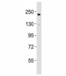 Western blot testing of RICTOR antibody at 1:2000 dilution + HepG2 lysate; Predicted molecular weigh