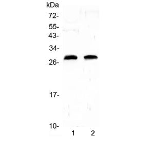 CRP Antibody / C-Reactive Protein