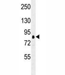 RSK1 / RPS6KA1 Antibody, 0.4ml