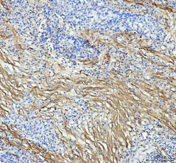 Collagen I Antibody / COL1A1