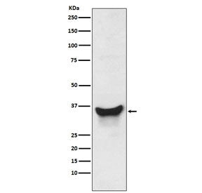 Western blot testing of human K562 cell lysate with Nix antibody. Expected molecular weight: ~38 kDa