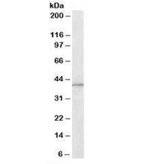 Western blot testing of human brain lysate with ADAP1 antibody at 1ug/ml. Predicted molecular weight