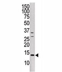 DUSP15 Antibody