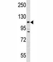 Lats2 Antibody