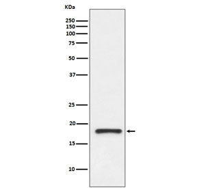 TTR Antibody / Transthyretin / Prealbumin