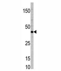 TCF7 Antibody