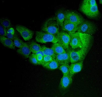 Immunofluorescent staining of FFPE human A431 cells with EPRS antibody (green) and DAPI nuclear stai