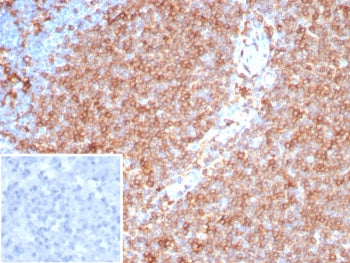 IHC staining of FFPE human tonsil tissue with Pan-HLA-II antibody (clone HLA-Pan/8311R). Inset: PBS 
