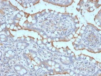 StAR Antibody / Steroidogenic acute regulatory protein