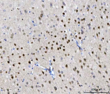 IHC staining of FFPE mouse brain tissue with CHD1 antibody. HIER: boil tissue sections in pH8 EDTA f