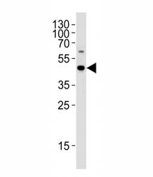 C9orf72 Antibody