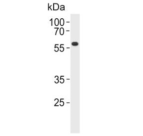 PPP2R2A Antibody