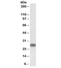 Western blot testing of human heart lysate with TNNI3 antibody at 1ug/ml. Predicted molecular weight