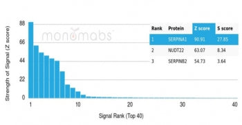 Analysis of a HuProt(TM) microarray containing more than 19,000 full-length human proteins using Alp