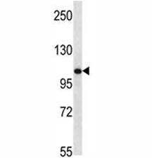 TLR8 antibody western blot analysis in mouse bladder tissue lysate. Expected molecular weight ~120 k
