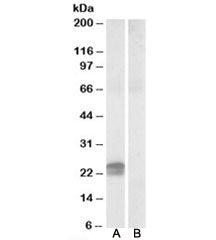 Western blot testing of human pancreas lysate with HMGA1 antibody at 0.5ug/ml with [B] and without [