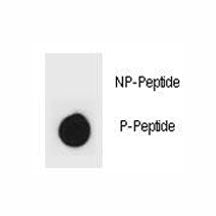 Phospho-IKK beta Antibody (pY609)