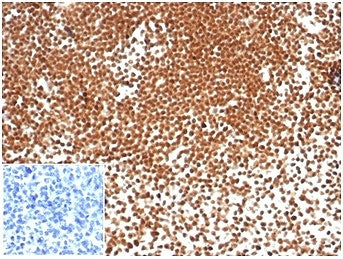 IHC staining of FFPE human tonsil tissue with recombinant NPM1 antibody. Negative control inset: PBS