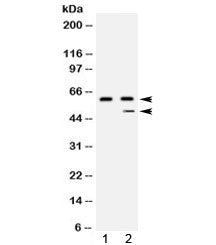 Western blot testing of 1) human placenta and 2) HepG2 lysate with Carboxypeptidase B2 antibody at 0