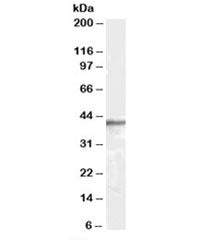 Western blot testing of human brain lysate with beta-Arrestin 2 antibody at 0.3ug/ml. Predicted molecular weight: 44~47 kDa (isoforms 1-5).