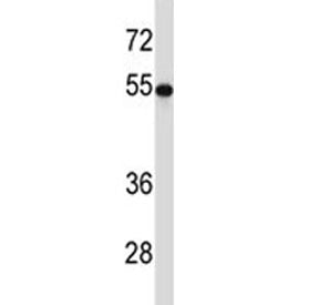 TUBB2A Antibody (Tubulin beta 2A)