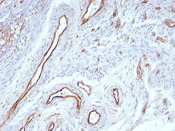 IHC staining of FFPE human uterus tissue with CD31 antibody (clone rPECAM1/8830). HIER: boil tissue 