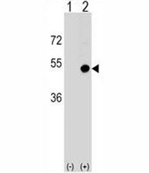 Western blot analysis of CD1d antibody and 293 cell lysate (2 ug/lane) either nontransfected (Lane 1