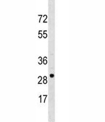 VDAC3 Antibody