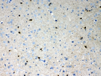 IHC testing of FFPE rat brain tissue with HCN2 antibody at 1ug/ml. Required HIER: steam section in p