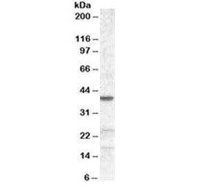 ABHD5 Antibody