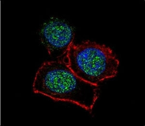 JMJD3 Antibody