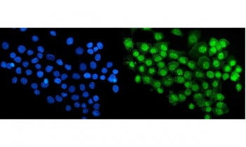 RBM47 Antibody