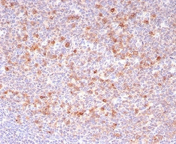 IHC staining of FFPE human tonsil tissue with B-cell maturation protein antibody (clone CD269/8190R)