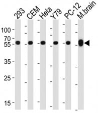 Tubulin beta 1 Antibody (TUBB1)