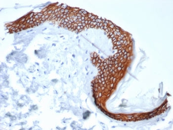 Syndecan-1 Antibody / CD138