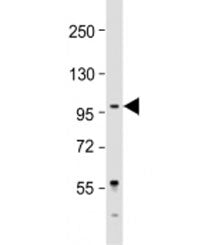 Western blot testing of Jurkat cell lysate with LARGE antibody at 1:2000. Predicted molecular weight