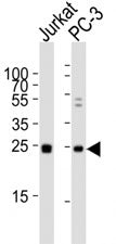 HMGB4 Antibody