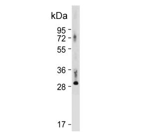 Thyroxine 5-deiodinase Antibody / DIO3