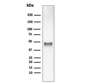 Cyclin E1 Antibody / CCNE1