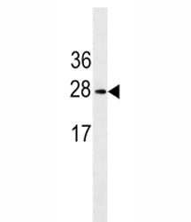 Erythropoietin antibody western blot analysis in K562 lysate. Expected molecular weight: 18-34 kDa d