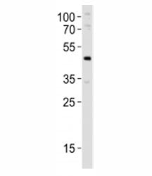 Western blot analysis of lysate from mouse pancreas tissue lysate using Pdx1 antibody at 1:1000. Obs