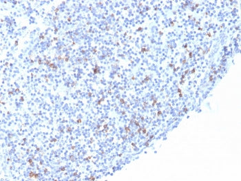 IHC staining of FFPE human tonsil with recombinant ITGAE antibody (clone rITGAE/2063). HIER: boil ti