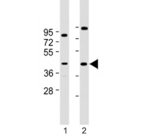 Prostaglandin D2 Receptor Antibody / PTGDR (C-Terminal Region)