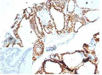 IHC staining of FFPE human thyroid tissue with recombinant CDH16 antibody (clone CHD16/7027R) at 2ug