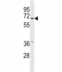 PINK Antibody