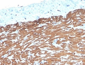 Desmin Antibody